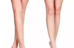 怎么瘦腿,科学方法打造完美腿型